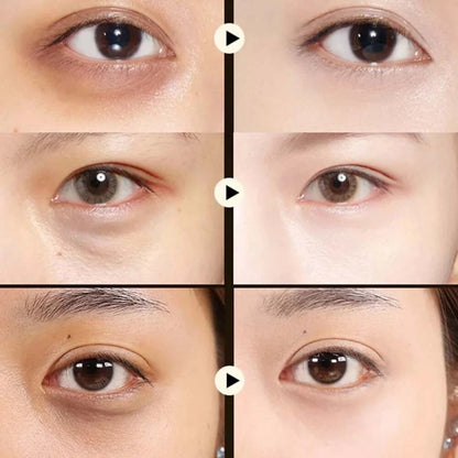 🥑Summer Hot Sale 🔥 Avocado Moisturizing Collagen Eye bagMask,60pcs/set