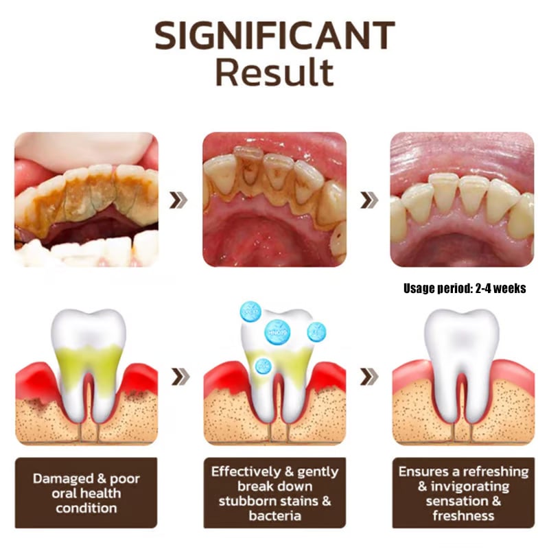 ✨ Achieve a Radiant Smile - 🦷 Niacinamide Whitening Toothpaste - For Healthier, Whiter Teeth!